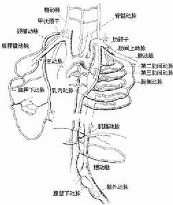 先天性主動脈縮窄