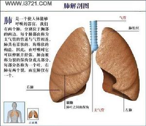 艾森曼格綜合症