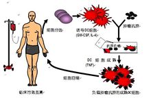 自體細胞免疫治療