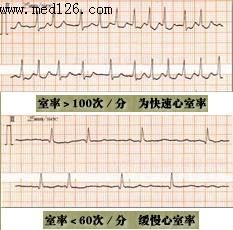 心電圖室