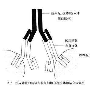 溫抗體型自身免疫性溶血性貧血