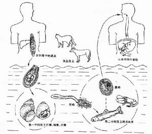 膽道華支睪吸蟲病