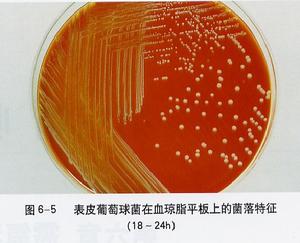 葡萄球菌腦膜炎