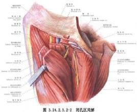 髂腰肌延長術