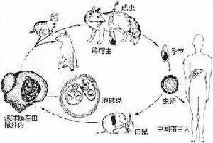 多房棘球蚴病