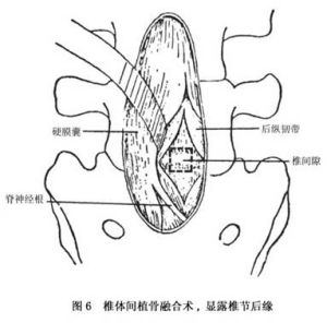 （圖）圖6