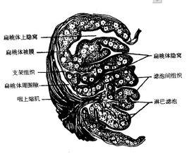 扁桃體隱窩