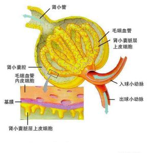 腎澱粉樣變性