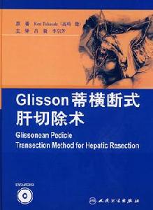 Glisson蒂橫斷式肝切除術