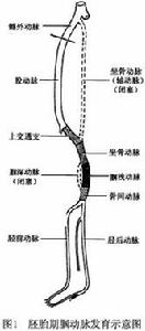 膕血管陷迫綜合徵