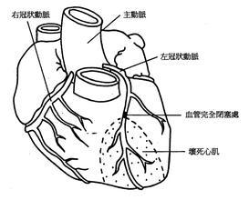 心漏病