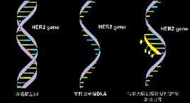 HER2基因檢測法