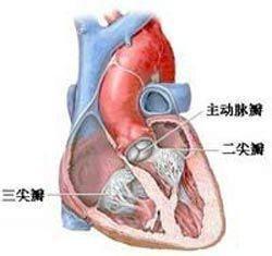 加速性室性自主心律