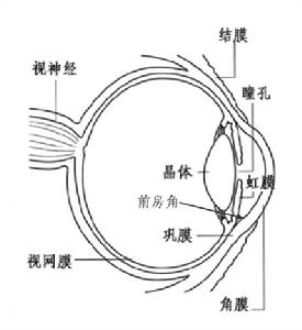 原發性慢性閉角型青光眼