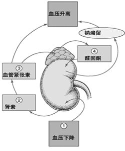 繼發性高血壓