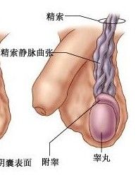 睪丸靜脈曲張