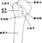 肱骨大結節骨折