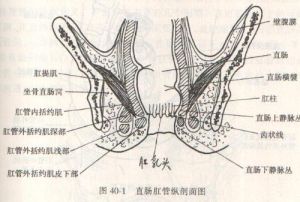 肛乳頭瘤