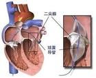 右心導管檢查術