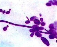 白假絲酵母菌
