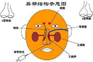 鼻前庭炎