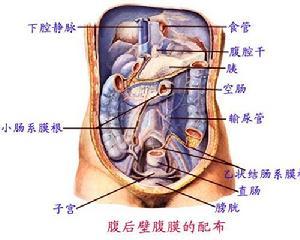 腹膜轉移癌