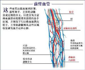 慢性病性貧血