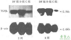 轉化生長因子-β