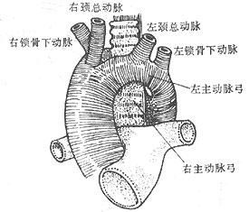 雙主動脈弓