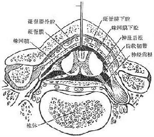 蛛網膜下腔