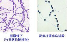 炭疽桿菌