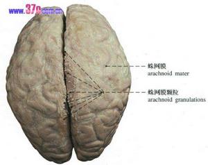 腦蛛網膜炎