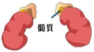 腎上腺髓質