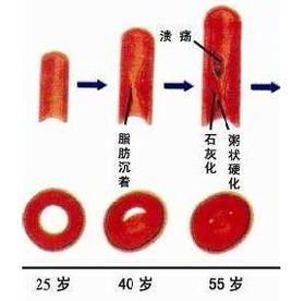 複方脈炎康