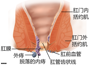 痔瘡是怎么形成的