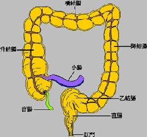 大腸息肉