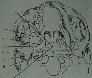 （圖）側顱底解剖圖