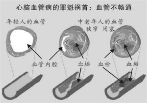 血毒