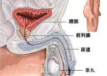 陰囊腫塊