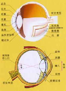 綠膿桿菌性角膜潰瘍