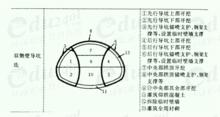 雙側壁導坑法