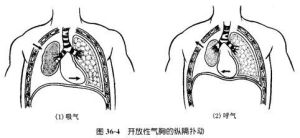 縱隔撲動