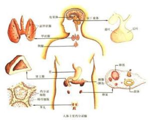 高雄激素血症