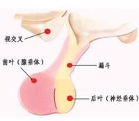 老年性腦萎縮