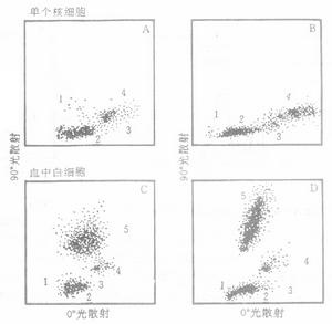 遺傳性進行性腎炎