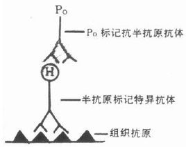 抗體酶