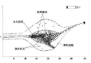 中國QBZ97自動步槍