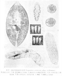 衛氏並殖吸蟲四川亞種