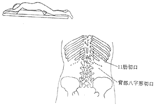 美替拉酮