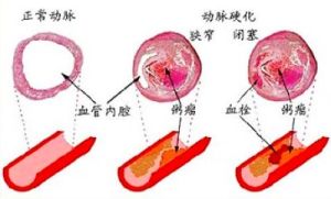 血管年齡